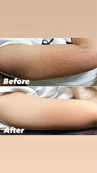 美肌脱毛専門店 ディオーネ四日市店のエステ・リラクイメージ