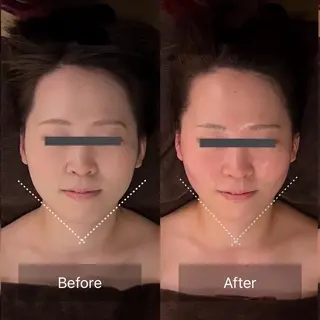 kogao&head Linoasのエステ・リラクイメージ