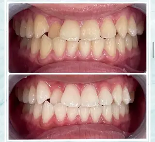 ホワイトニング ビューティ名古屋栄のその他イメージ