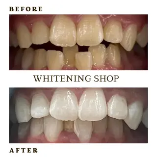 メンズ ホワイトニング ショップ葛西店のその他イメージ