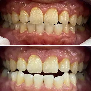 whiteclub THREEのその他イメージ