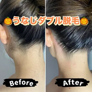 エピナス町田店 ブラジリアンワックスのエステ・リラクイメージ