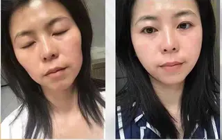 aliaハーブ水光店 エステティシャン募集のエステ・リラクイメージ