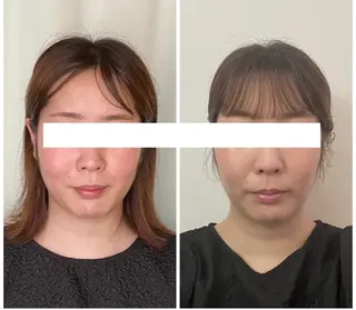 丸顔さんの救世主 高田 くみのエステ・リラクイメージ