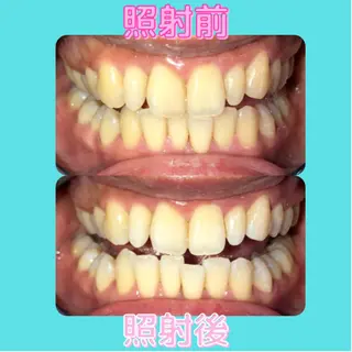 韓国式3D毛穴洗浄 lonhanaのその他イメージ