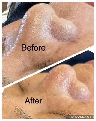 o3remedy所属・宇野澤 彩加のエステ・リラクイメージ