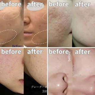 カラー 愛維美水光美肌専門店所属・愛維美水光美肌専門店 メンズレディースokのエステ・リラクイメージ