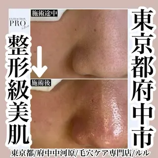 LULU ルルのエステ・リラクイメージ