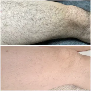 脱毛・ホワイトニング 耳ツボ・美白・毛穴のその他イメージ