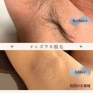 メンズ 美肌脱毛/骨盤ケア /肩こり/慢性疲労のエステ・リラクイメージ