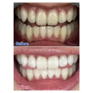 Ｍ渋谷 ホワイトニングのエステ・リラクイメージ