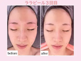 💜Karen PrivateSpaのエステ・リラクイメージ