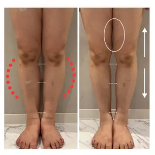 大谷アヤ 体質改善のエステ・リラクイメージ