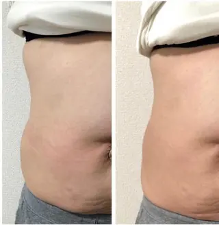 【美容整形級エステ】 服部隆美のエステ・リラクイメージ