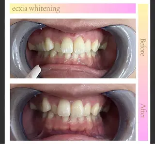 エクシアホワイト長野店所属・セルフホワイトニング エクシア長野店のその他イメージ