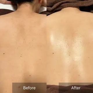 肌育ピーリング 🫧megumiのエステ・リラクイメージ