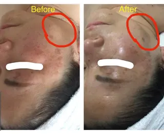 子宮矯正/腸揉み/ シュガーリング脱毛のエステ・リラクイメージ