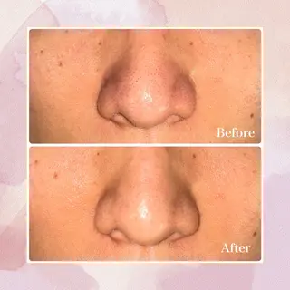 Bellebeau tysalonのエステ・リラクイメージ