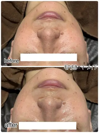 ENCHANT 脱毛.小顔.毛穴のエステ・リラクイメージ