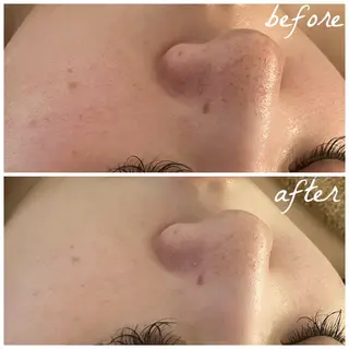 メンズ メナード岐阜市茜部 杉浦のエステ・リラクイメージ