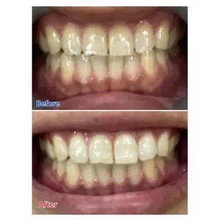 Ｍ渋谷 ホワイトニングのエステ・リラクイメージ