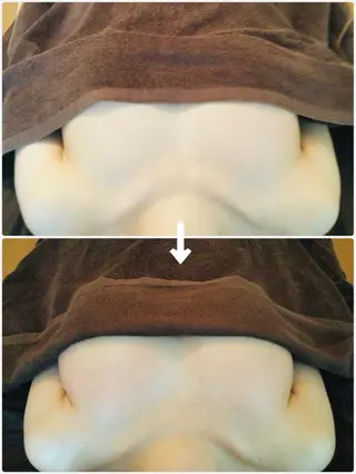 EXTR エクスターのエステ・リラクイメージ