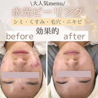 Total beauty salon  Brilliant所属・ROCO yuiの眉毛・アイブロウイメージ