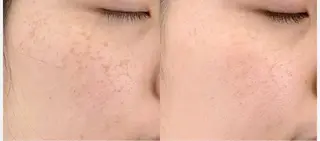 肌質改善sui所属・肌質改善 suiのエステ・リラクイメージ