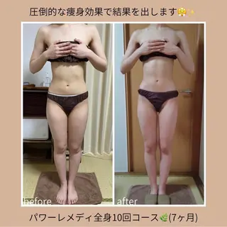 《本気痩せ×疲労改善 》  BILOOPのエステ・リラクイメージ