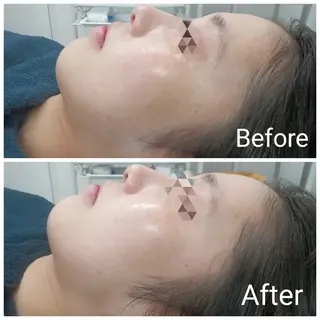 肌質改善Beauty salon Renのエステ・リラクイメージ