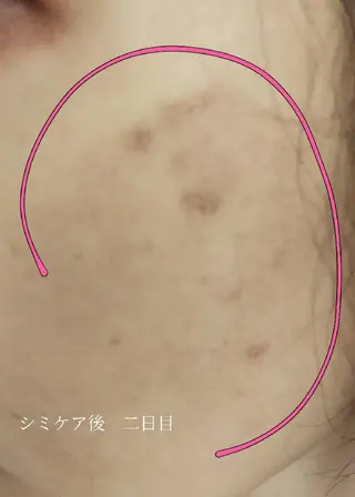 🅖🅤🅩🅔🅛 salonのエステ・リラクイメージ
