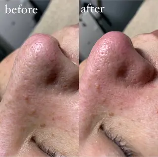 private salon arのマツエク・マツパデザイン