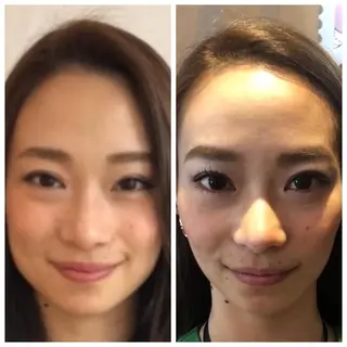 💙美容鍼💙美顔矯 正🧡Brilo🧡のエステ・リラクイメージ