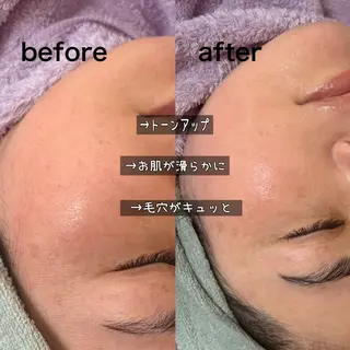 noheanc所属・まつげと艶肌 サロンのエステ・リラクイメージ