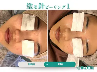 【脱毛・美肌専門】メンズ&レディースサロンBell style所属・【脱毛・美肌専門】 bellstyleのエステ・リラクイメージ
