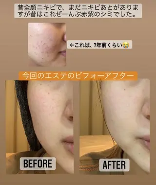 I. Ayaのエステ・リラクイメージ