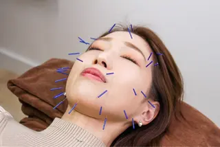 小顔/美容鍼/整体 MITSUKIのその他イメージ