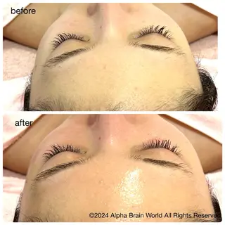 脱毛/美肌【皮膚科看 護師経営】ラベニールのエステ・リラクイメージ