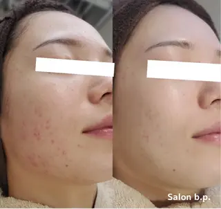 Salon b.p. 渋谷のエステ・リラクイメージ