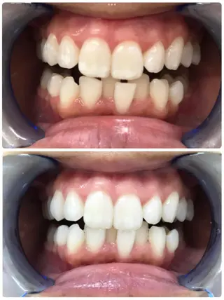 noel de mi 前川亜里沙のエステ・リラクイメージ