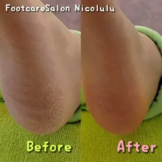 足トラブル専門 ニコルル金沢のエステ・リラクイメージ