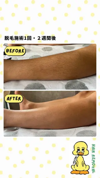 blue.💙【 脱毛&フェイシャル】のエステ・リラクイメージ