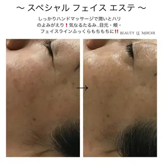 ビューティー ミロワールのエステ・リラクイメージ
