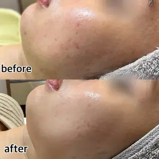 ネイル クロス ラニ 深爪矯正もお任せのネイルデザイン