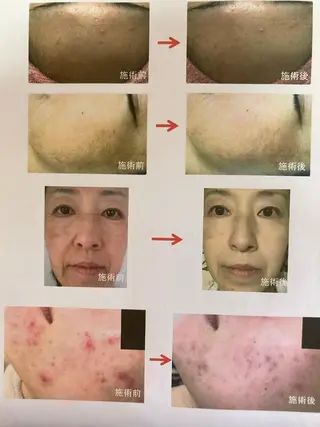 伊藤 幸子のエステ・リラクイメージ