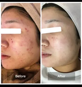 ハーブピーリング専門 MOKAのエステ・リラクイメージ