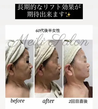 meili salonのエステ・リラクイメージ