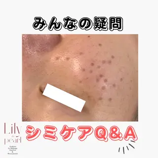 最新シミケアLily de pearlのエステ・リラクイメージ