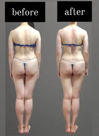 Ichi Fluo rite Bodyのエステ・リラクイメージ