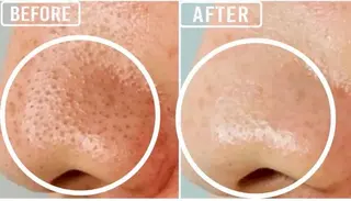 毛穴/毛穴洗浄専門 エミルカ船橋のエステ・リラクイメージ